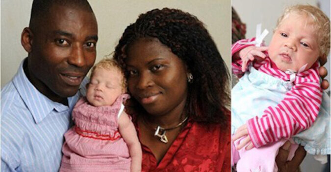 Schneewittchen wurde vor 10 Jahren in einer nigerianischen Familie geboren. Wie sieht das Mädchen jetzt aus?